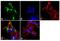 Neurofilament Heavy antibody, MA5-15234, Invitrogen Antibodies, Immunofluorescence image 