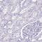 Outer Dense Fiber Of Sperm Tails 3B antibody, NBP2-32371, Novus Biologicals, Immunohistochemistry paraffin image 