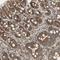 Murine Retrovirus Integration Site 1 Homolog antibody, NBP1-87877, Novus Biologicals, Immunohistochemistry frozen image 