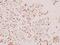 Spleen Associated Tyrosine Kinase antibody, A00490, Boster Biological Technology, Immunohistochemistry paraffin image 