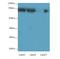 Adaptor Related Protein Complex 4 Subunit Beta 1 antibody, A58090-100, Epigentek, Western Blot image 