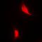 Zinc Finger Protein 500 antibody, orb78463, Biorbyt, Immunofluorescence image 