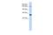 Enhancer Of MRNA Decapping 4 antibody, A05173-1, Boster Biological Technology, Western Blot image 