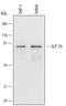Lymphocyte Cytosolic Protein 2 antibody, MAB5637, R&D Systems, Western Blot image 