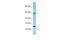 DNA Polymerase Epsilon 3, Accessory Subunit antibody, A12109, Boster Biological Technology, Western Blot image 