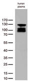 Complement C6 antibody, M00317, Boster Biological Technology, Western Blot image 
