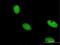 Zinc Finger Protein 274 antibody, MA5-21159, Invitrogen Antibodies, Immunofluorescence image 