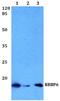 RB Binding Protein 6, Ubiquitin Ligase antibody, A04382, Boster Biological Technology, Western Blot image 