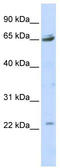 Purinergic Receptor P2X 2 antibody, TA338776, Origene, Western Blot image 