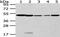 Cytochrome P450 Family 20 Subfamily A Member 1 antibody, PA5-51248, Invitrogen Antibodies, Western Blot image 