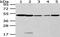 Cytochrome P450 Family 20 Subfamily A Member 1 antibody, PA5-51248, Invitrogen Antibodies, Western Blot image 