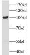 OTU Deubiquitinase 7B antibody, FNab06043, FineTest, Western Blot image 