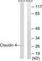 Claudin 4 antibody, LS-C198810, Lifespan Biosciences, Western Blot image 