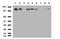 DNA Topoisomerase II Alpha antibody, LS-C796864, Lifespan Biosciences, Western Blot image 