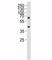 Lysine Methyltransferase 5A antibody, F40198-0.4ML, NSJ Bioreagents, Immunohistochemistry paraffin image 