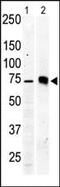 Protein Kinase C Beta antibody, PA5-13741, Invitrogen Antibodies, Western Blot image 