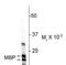 Myelin Basic Protein antibody, NBP2-29656, Novus Biologicals, Western Blot image 