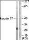 Keratin 17 antibody, orb95976, Biorbyt, Western Blot image 