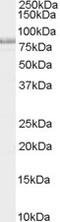 NUMB Endocytic Adaptor Protein antibody, 45-101, ProSci, Western Blot image 
