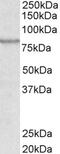 ATP Binding Cassette Subfamily B Member 5 antibody, PA5-18844, Invitrogen Antibodies, Western Blot image 