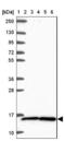 Tax1 Binding Protein 3 antibody, NBP2-38016, Novus Biologicals, Western Blot image 