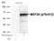 Myocyte Enhancer Factor 2A antibody, PA5-37642, Invitrogen Antibodies, Western Blot image 
