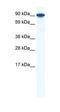 Zinc finger Y-chromosomal protein 1 antibody, orb324675, Biorbyt, Western Blot image 