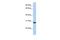 Claudin Domain Containing 1 antibody, PA5-42670, Invitrogen Antibodies, Western Blot image 