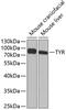 Tyrosinase antibody, GTX16389, GeneTex, Western Blot image 