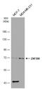 Zinc Finger Protein 398 antibody, GTX107221, GeneTex, Western Blot image 