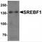 Sterol Regulatory Element Binding Transcription Factor 1 antibody, MBS153521, MyBioSource, Western Blot image 