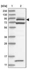 ArfGAP With Coiled-Coil, Ankyrin Repeat And PH Domains 2 antibody, PA5-57068, Invitrogen Antibodies, Western Blot image 