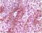 RAB25, Member RAS Oncogene Family antibody, 32-208, ProSci, Immunohistochemistry paraffin image 