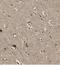 Kelch Like Family Member 15 antibody, FNab04615, FineTest, Immunohistochemistry paraffin image 