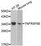 Tumor necrosis factor receptor superfamily member 6B antibody, LS-C748690, Lifespan Biosciences, Western Blot image 