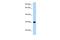 Pleckstrin Homology And FYVE Domain Containing 2 antibody, PA5-69711, Invitrogen Antibodies, Western Blot image 