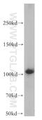 Mitogen-Activated Protein Kinase 6 antibody, 12839-1-AP, Proteintech Group, Western Blot image 