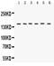 Rho Associated Coiled-Coil Containing Protein Kinase 2 antibody, PB9387, Boster Biological Technology, Western Blot image 