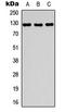 Myosin Binding Protein C, Slow Type antibody, LS-C356198, Lifespan Biosciences, Western Blot image 