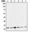 NME/NM23 Nucleoside Diphosphate Kinase 2 antibody, orb214322, Biorbyt, Western Blot image 