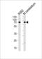 EPM2A-interacting protein 1 antibody, PA5-49324, Invitrogen Antibodies, Western Blot image 