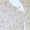 Retinoic Acid Receptor Alpha antibody, LS-C330934, Lifespan Biosciences, Immunohistochemistry paraffin image 