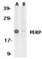 P53 Apoptosis Effector Related To PMP22 antibody, ab5986, Abcam, Western Blot image 