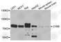Cytochrome B-245 Beta Chain antibody, A1636, ABclonal Technology, Western Blot image 