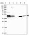 Tropomodulin 2 antibody, PA5-59536, Invitrogen Antibodies, Western Blot image 