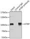 ATR Interacting Protein antibody, 19-525, ProSci, Immunoprecipitation image 