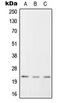 Regulator Of G Protein Signaling 1 antibody, LS-C352775, Lifespan Biosciences, Western Blot image 