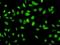 Family With Sequence Similarity 216 Member A antibody, H00029902-D01P, Novus Biologicals, Immunocytochemistry image 