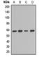 Ectonucleoside Triphosphate Diphosphohydrolase 1 antibody, LS-B15832, Lifespan Biosciences, Western Blot image 