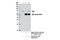 Spleen Associated Tyrosine Kinase antibody, 13198S, Cell Signaling Technology, Immunoprecipitation image 
